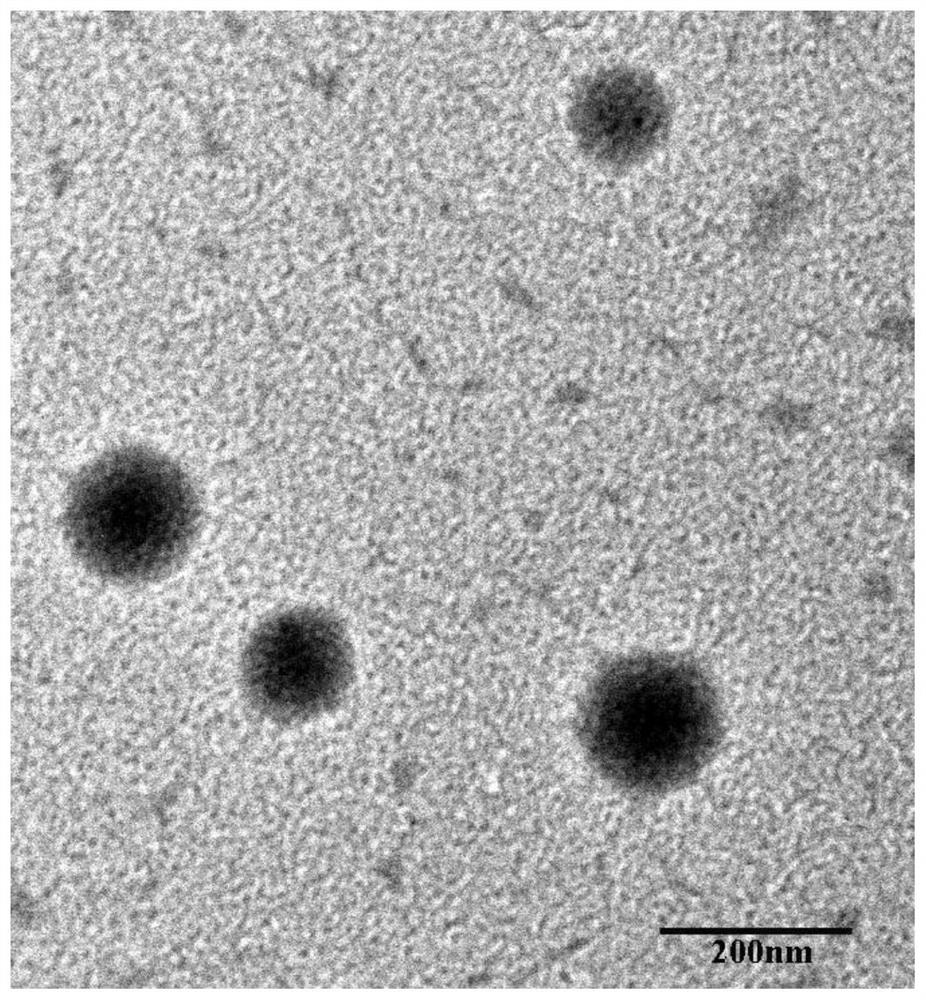 BCG (bacillus calmette-guerin) vaccine complex combined with nano drug carrier and preparation method of BCG vaccine complex