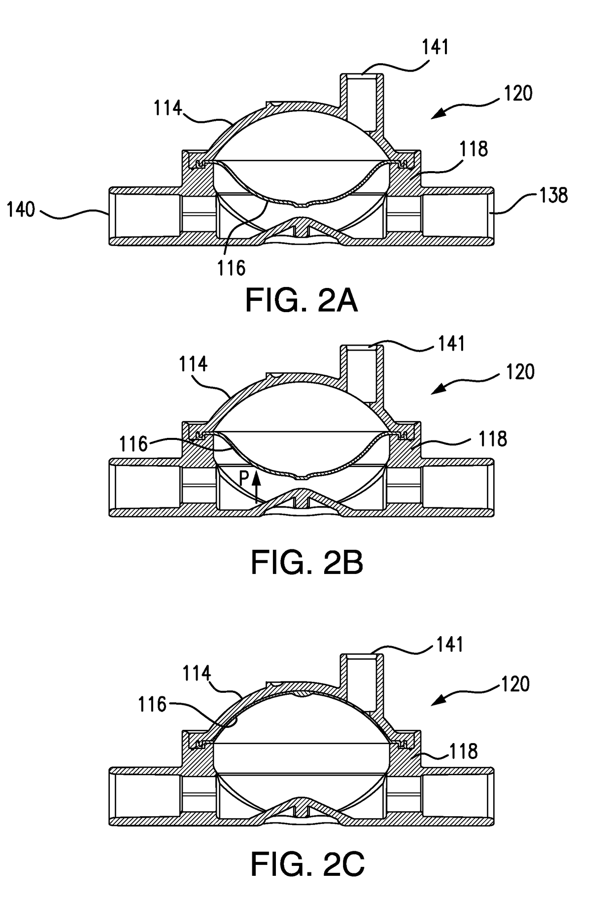 Pressure output device for extracorporeal hemodialysis machine