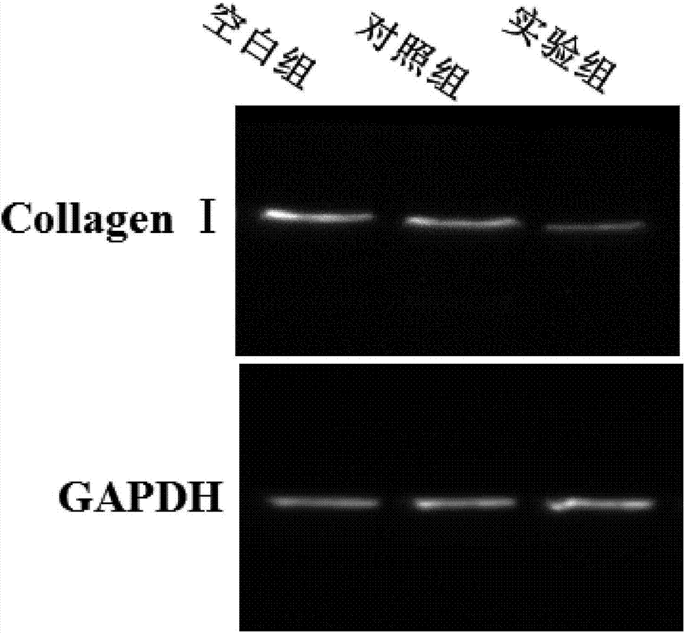 Multifunctional nanofiber wound repair biological dressing and preparation method thereof