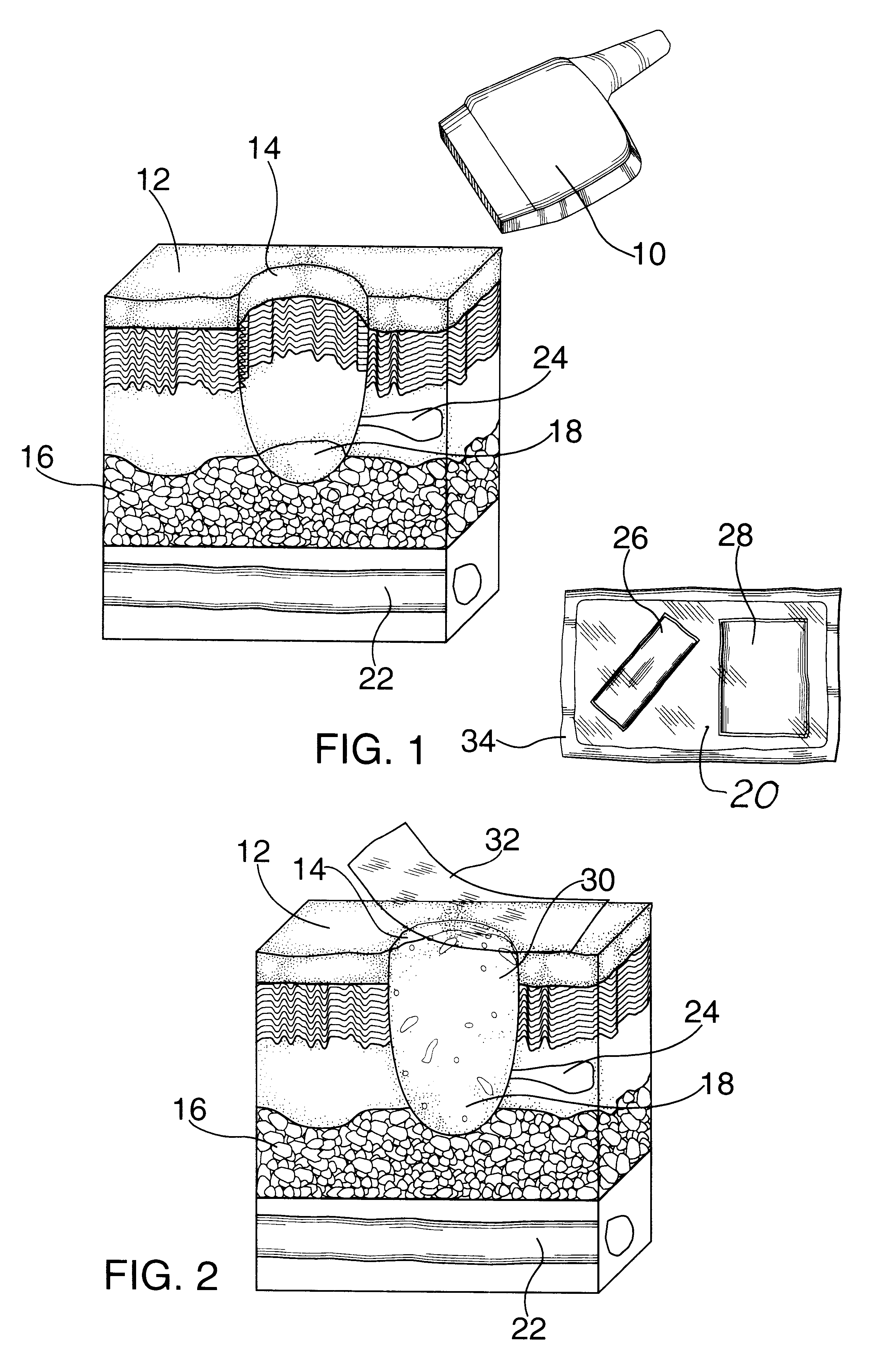 Method and kit for wound evaluation