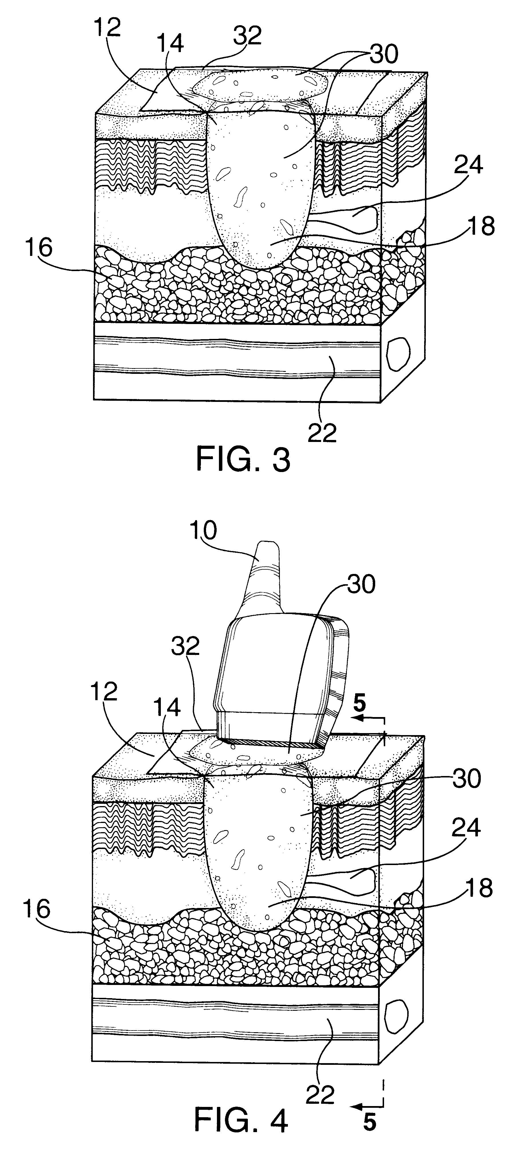 Method and kit for wound evaluation