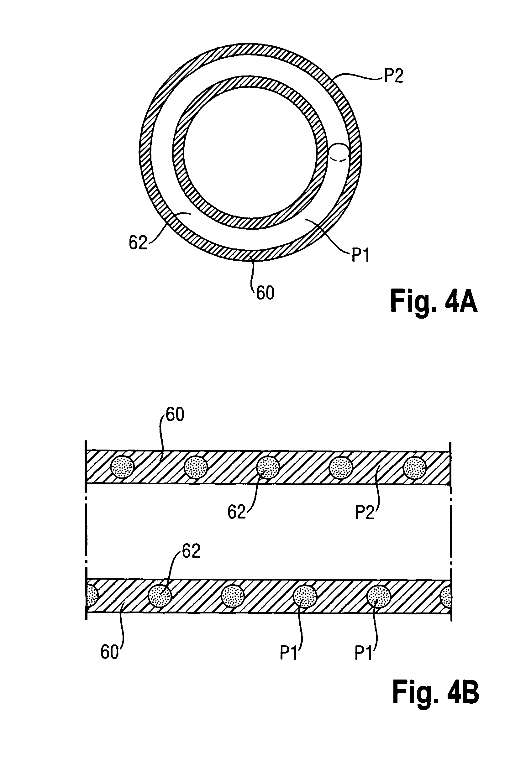 Polymer prosthesis