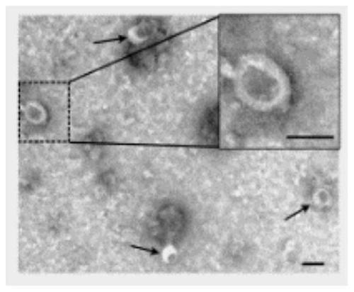 Exosome for mass spectrometric flow cytometry detection and preparation method and application thereof