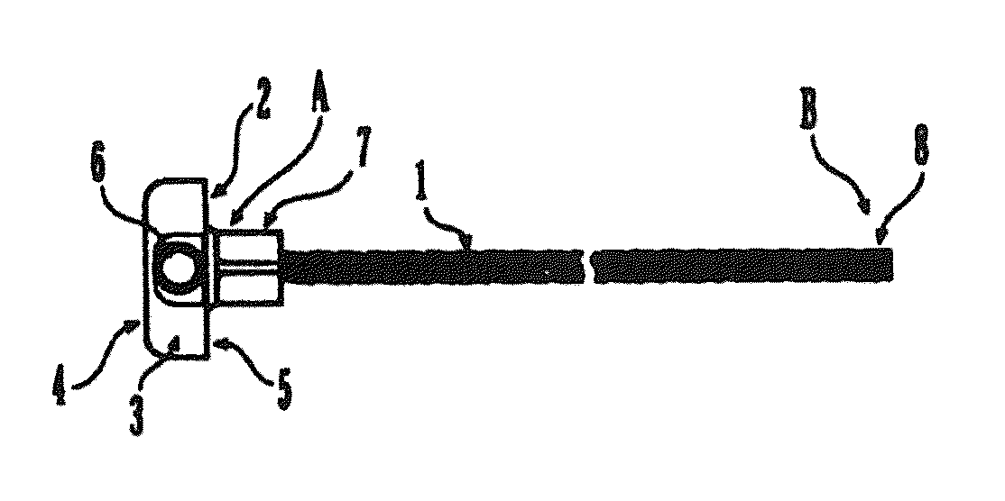 Sternal reconstruction system