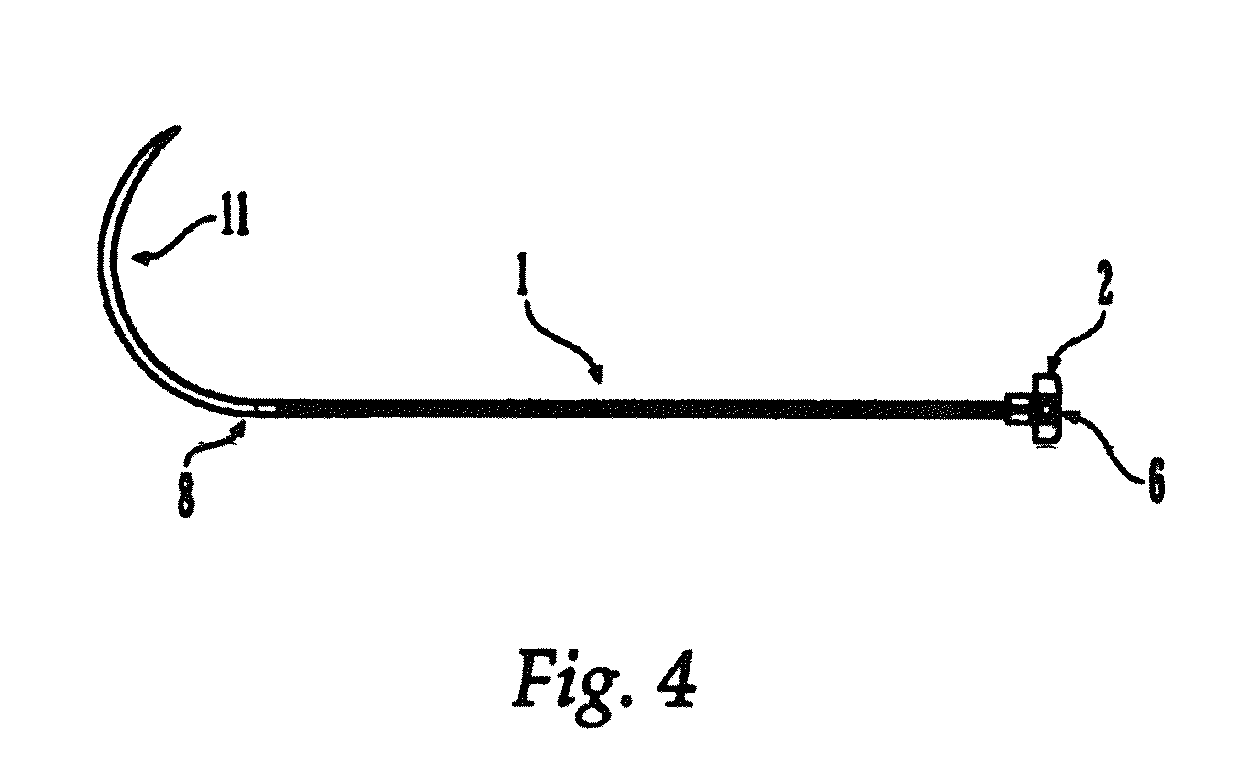 Sternal reconstruction system