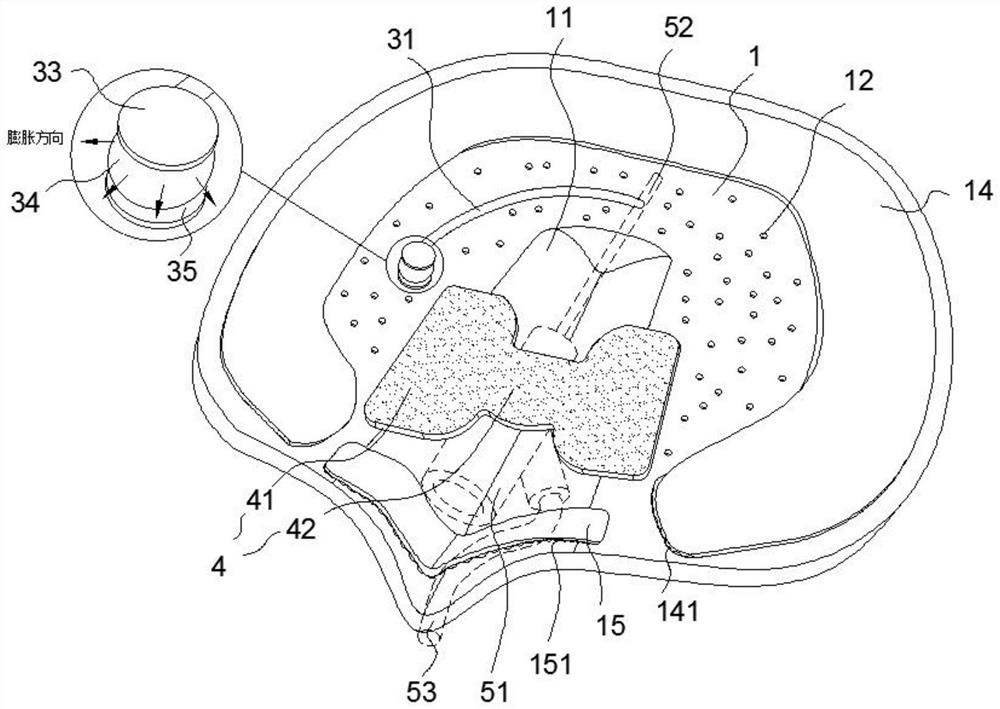 A kind of intravenous indwelling needle patch