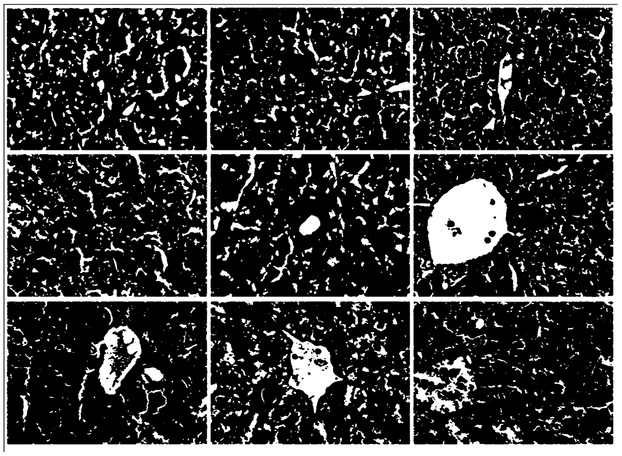 Establishment method of iron overload mouse model corresponding to thalassemia pesaro risk classification