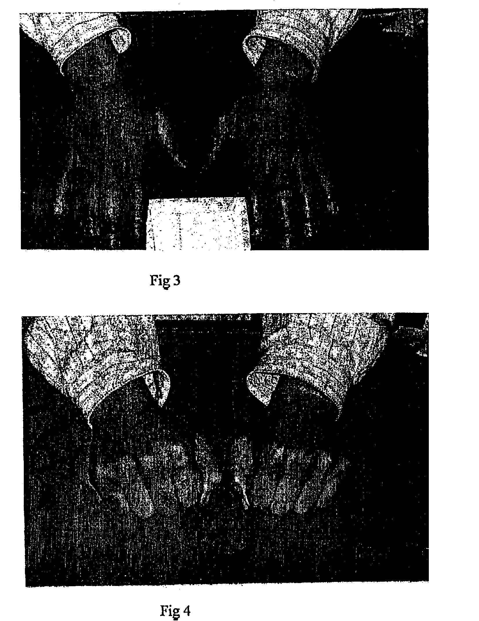 Pharmaceutical gel composition