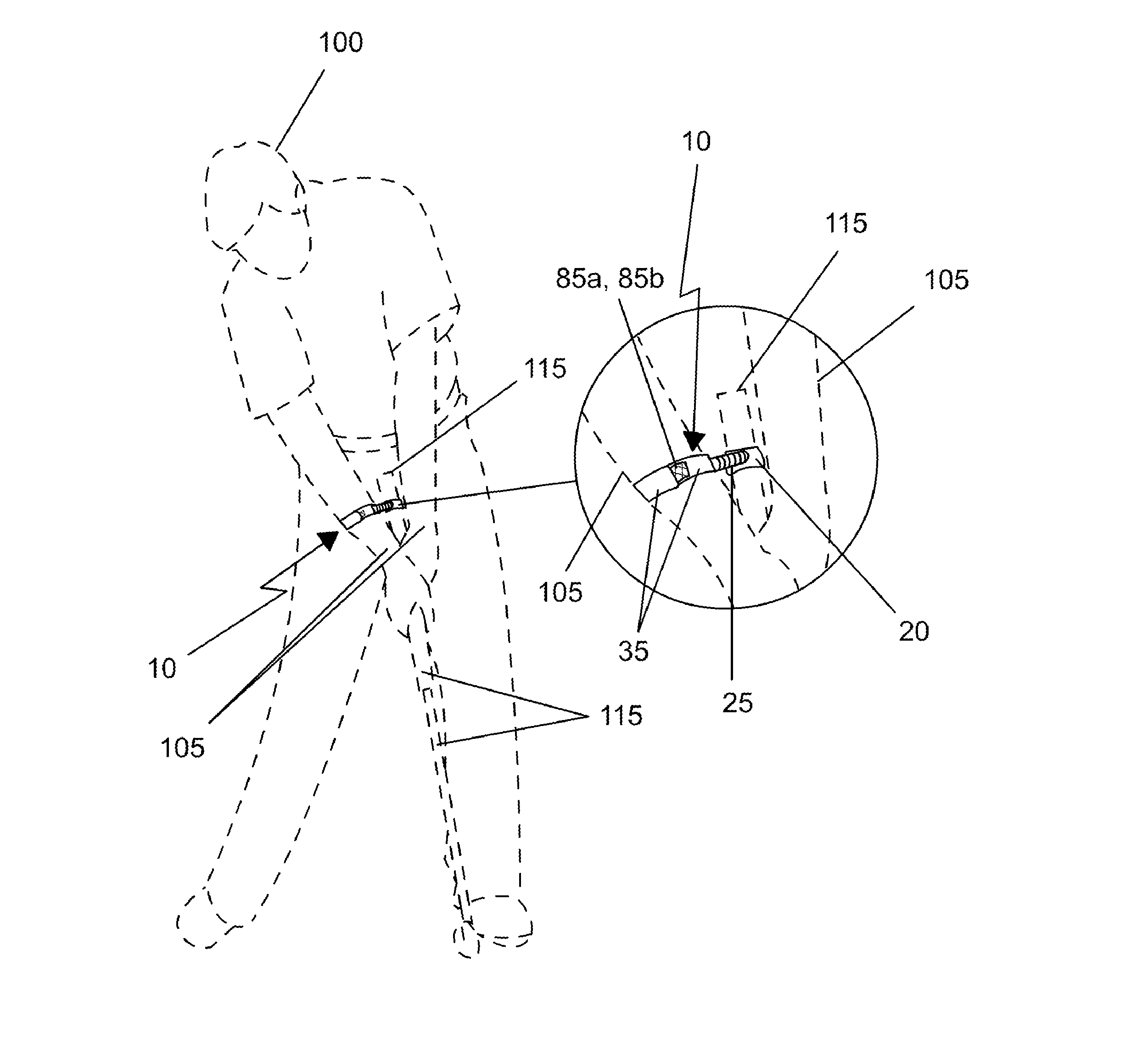 Golf swing training device