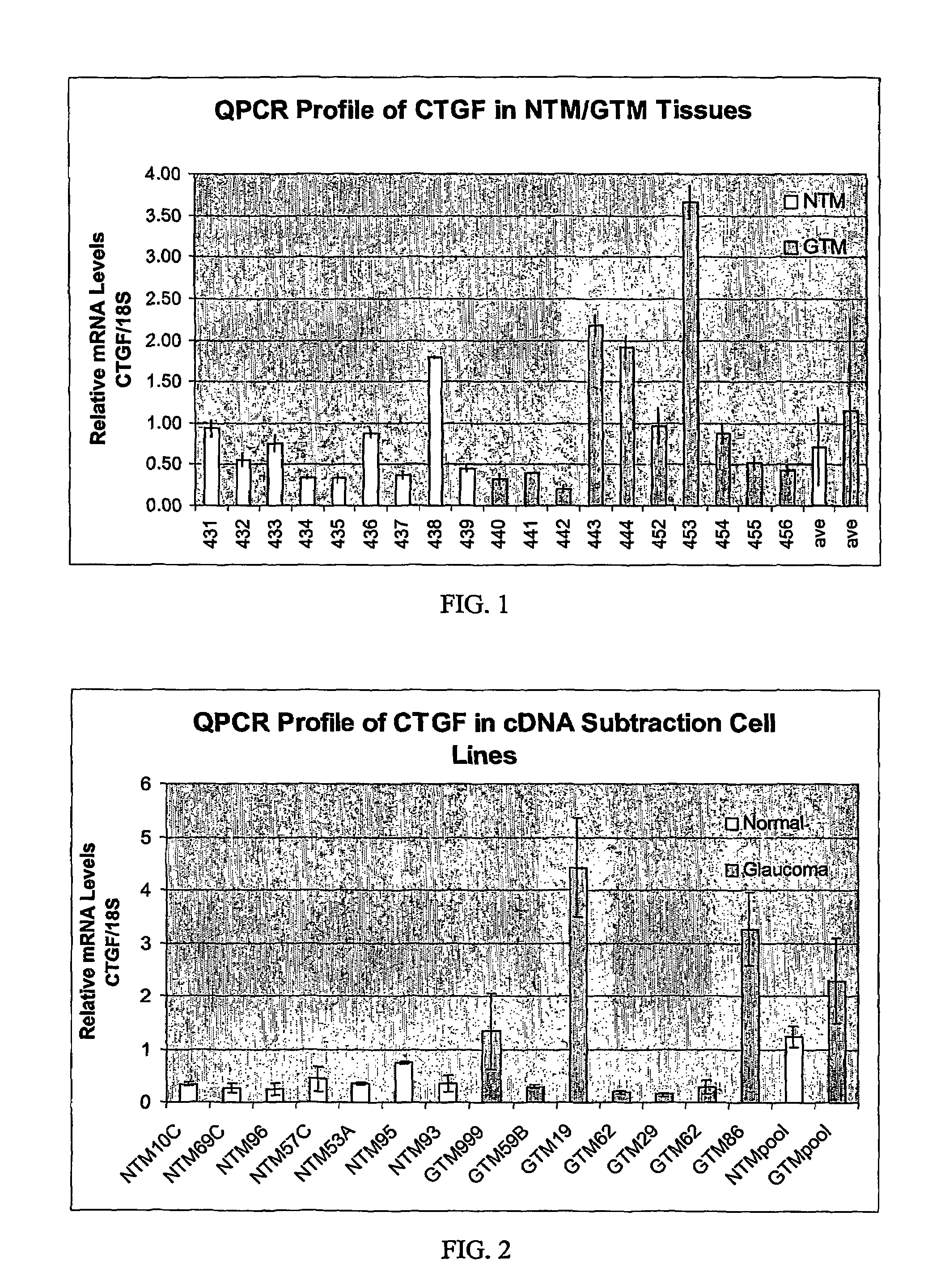 Agents which regulate, inhibit, or modulate the activity and/or expression of connective tissue growth factor (CTGF) as a unique means to both lower intraocular pressure and treat glaucomatous retinopathies/optic neuropathies