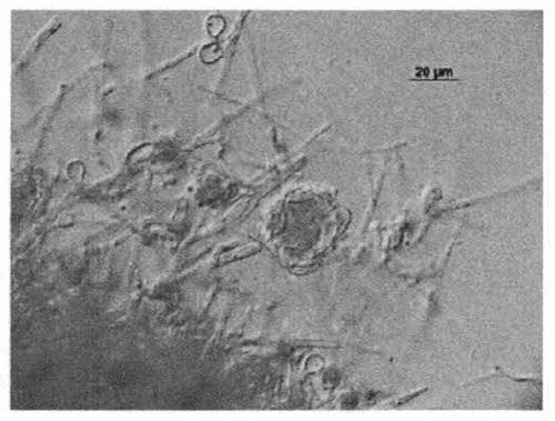 Monascus purpureus induced strain and water-soluble functional monascus as well as preparation method and application of water-soluble functional monascus