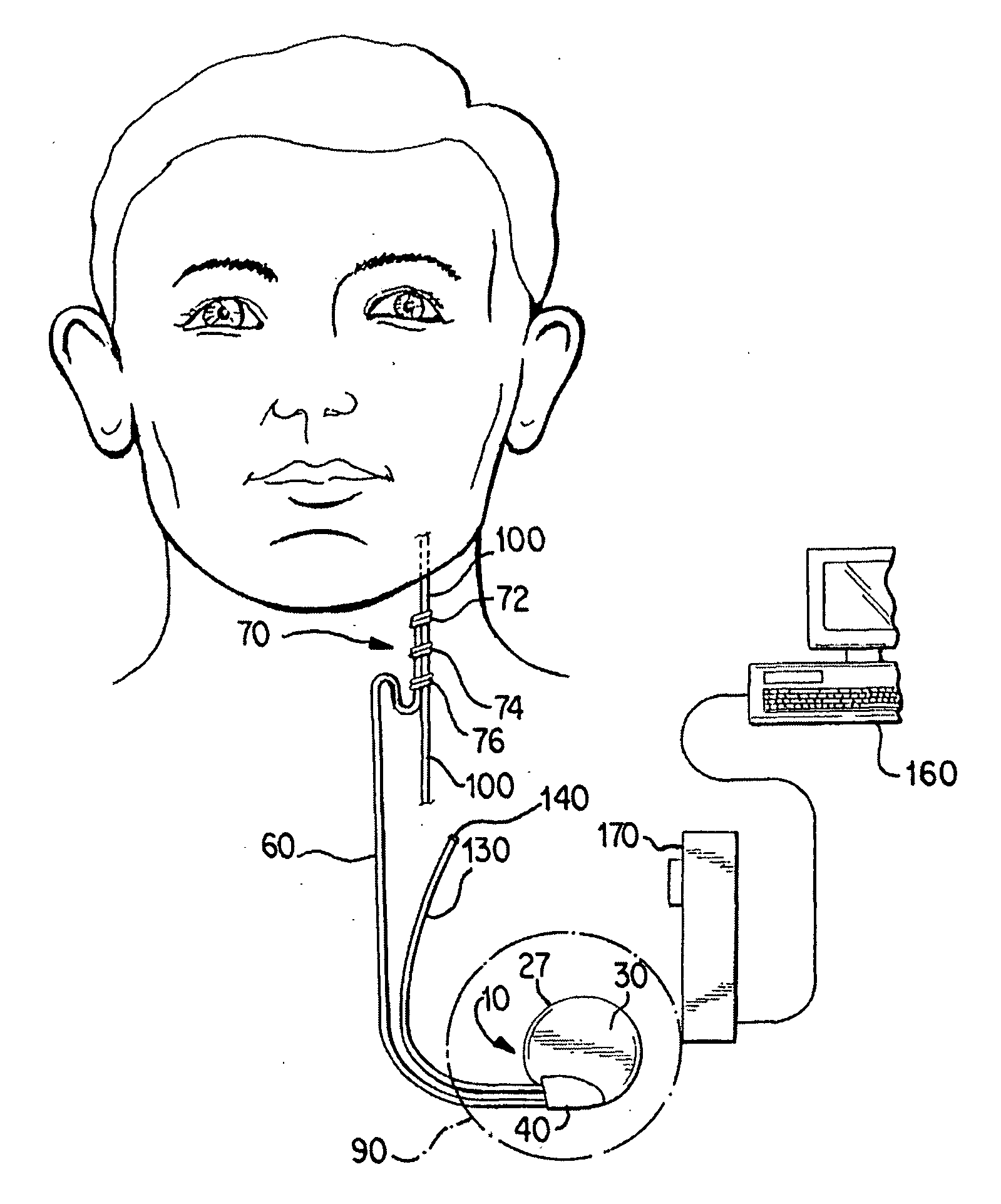 Neurostimulator with activation based on changes in body temperature