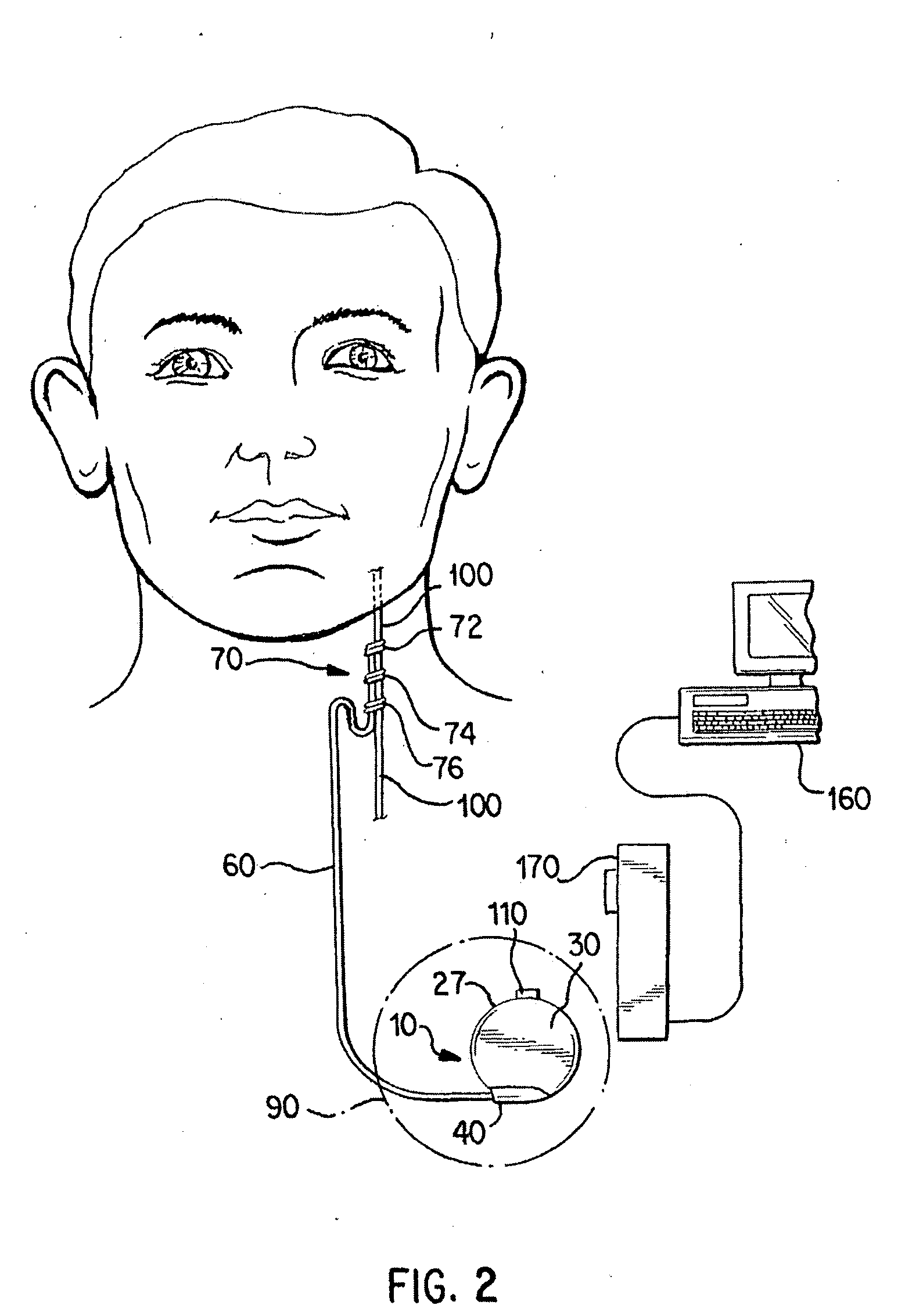 Neurostimulator with activation based on changes in body temperature