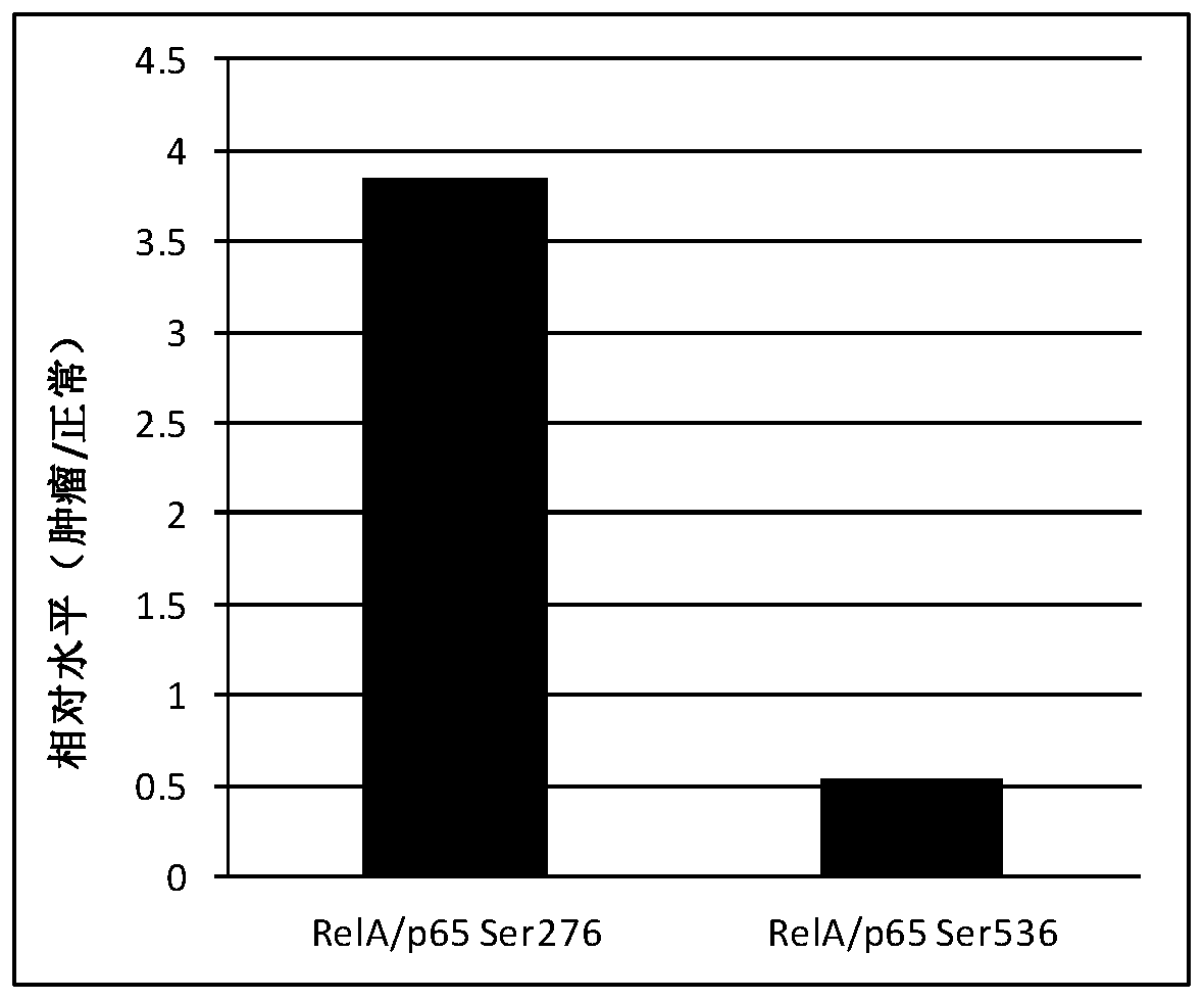 NF-kappaB RelA/p65 protein loci specificity phosphorylation diagnosis kit