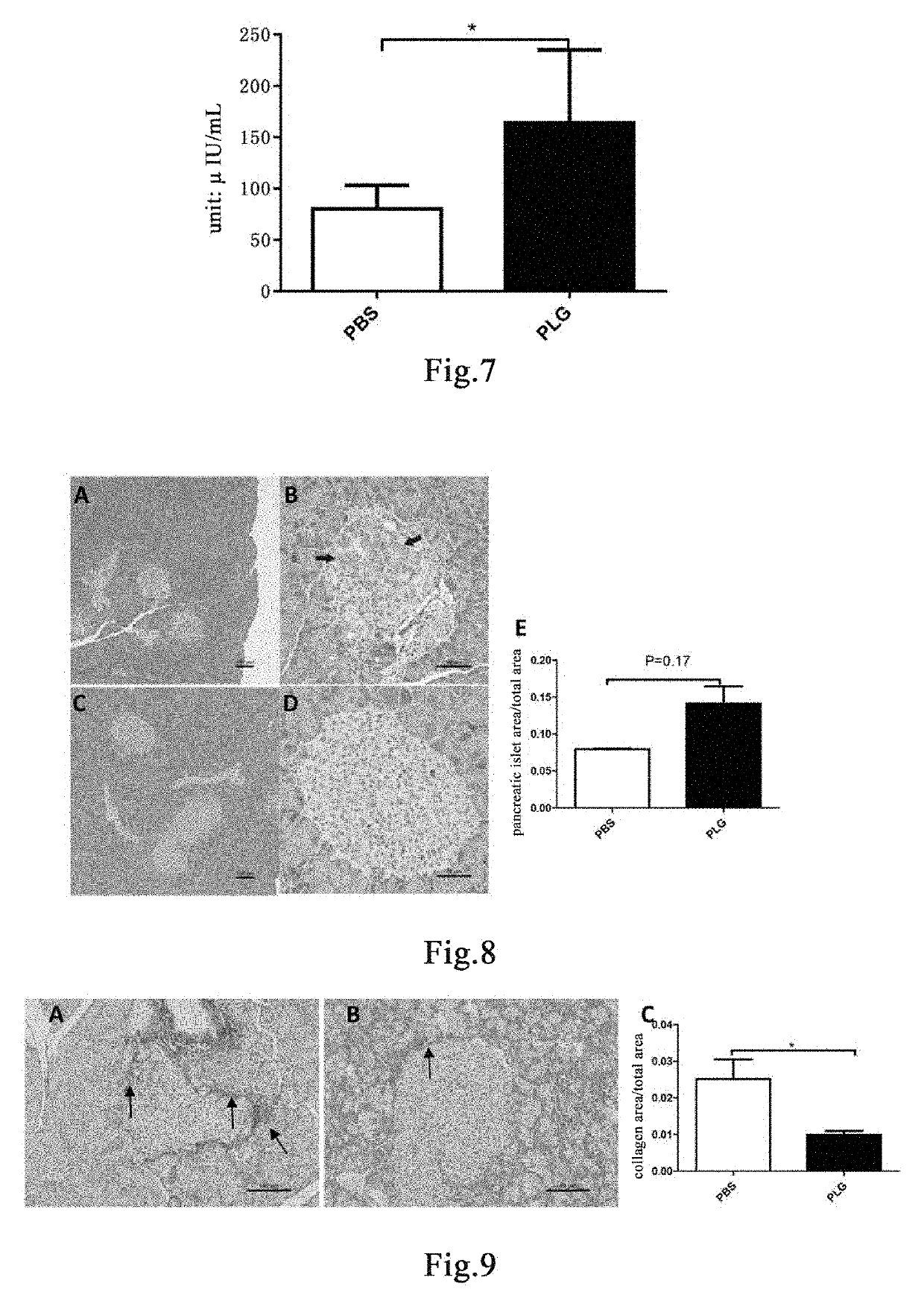 Novel method for treating diabetes