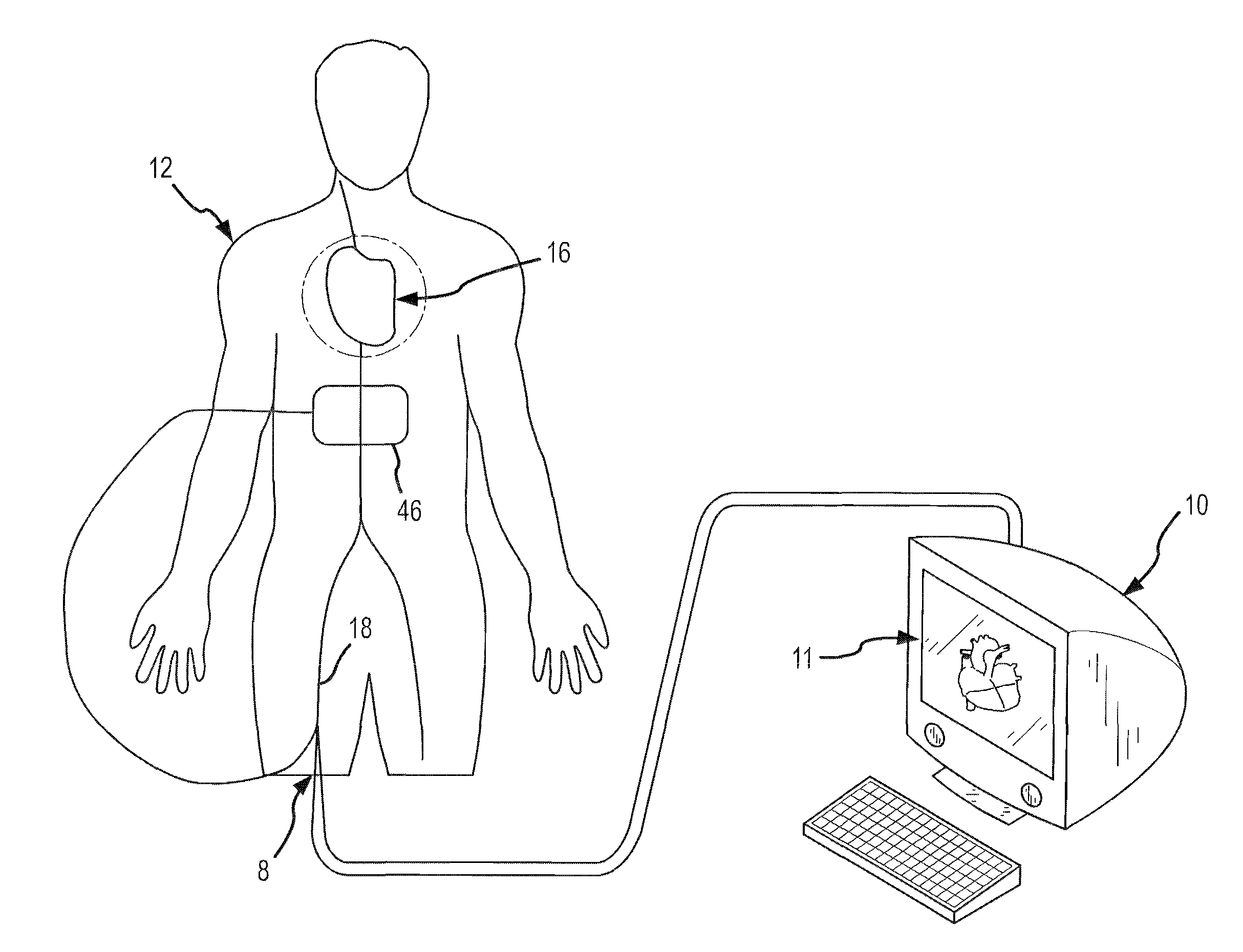 Contact sensor and sheath exit sensor