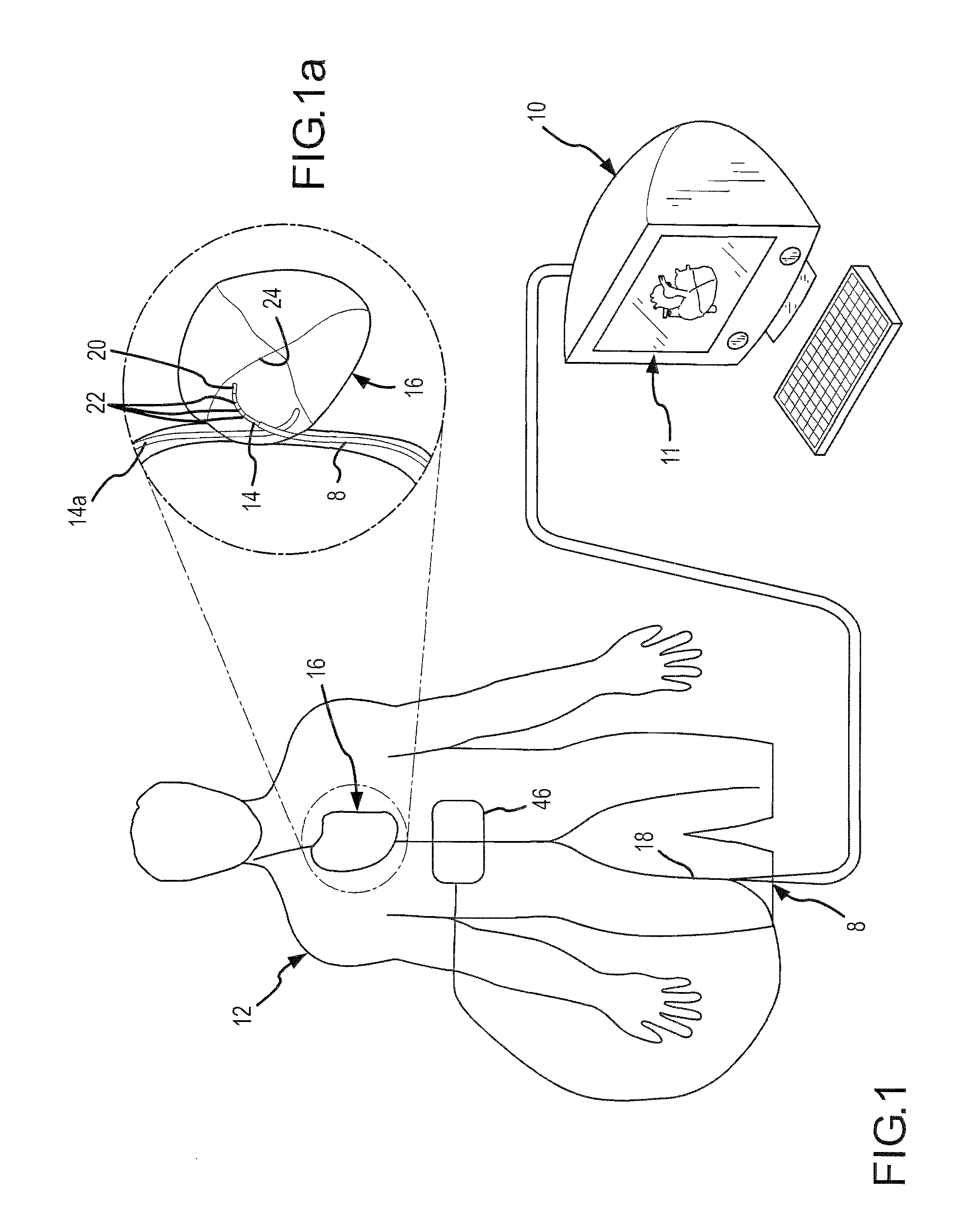 Contact sensor and sheath exit sensor