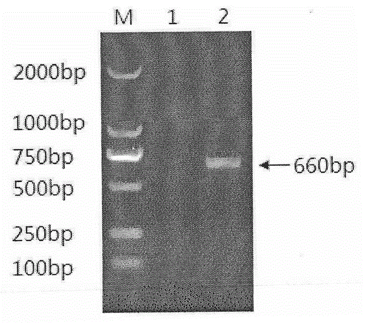 Novel porcine reproductive and respiratory syndrome virus variant GP5 recombinant protein and preparation method and application thereof