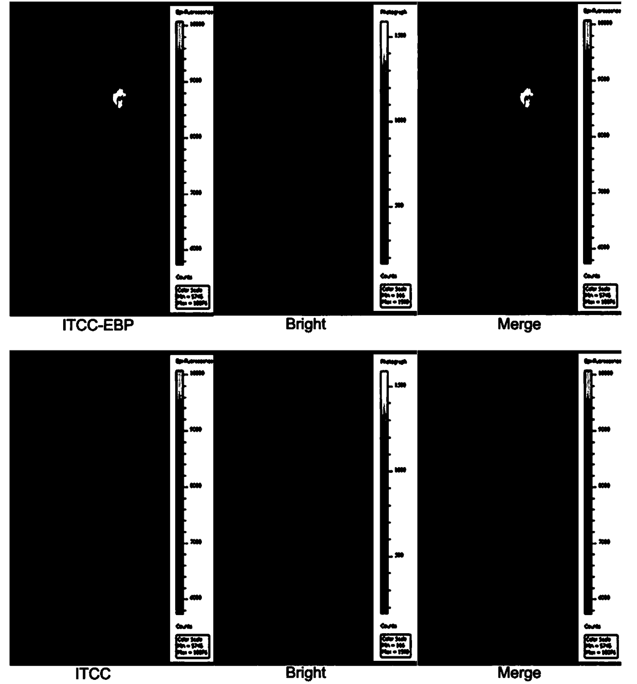 Tumor-targeting near-infrared fluorescent probe and preparation method thereof