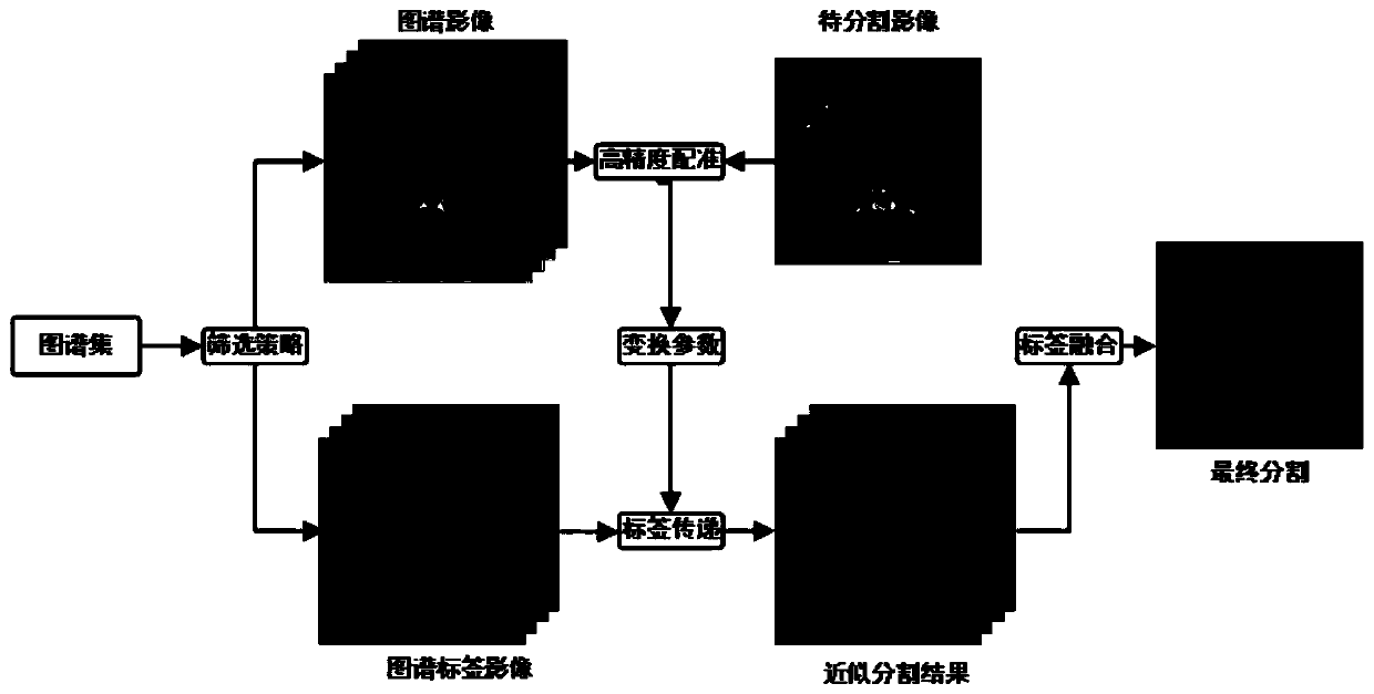 A Liver CT Atlas Segmentation Method and System Based on High Precision Registration