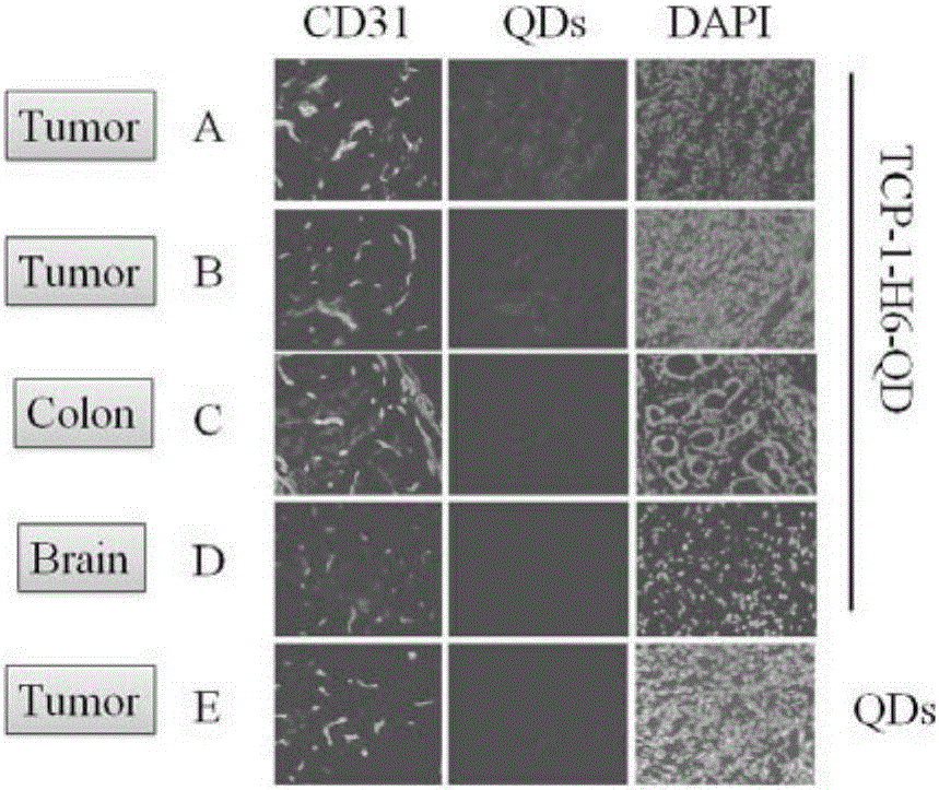 Quantum dot targeting probe kit for detecting tumor of colon cancer