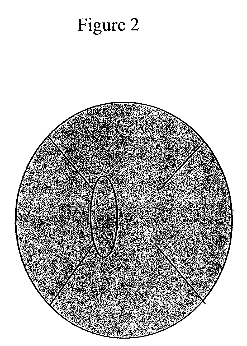 Compositions and methods for treating eye disorders and conditions