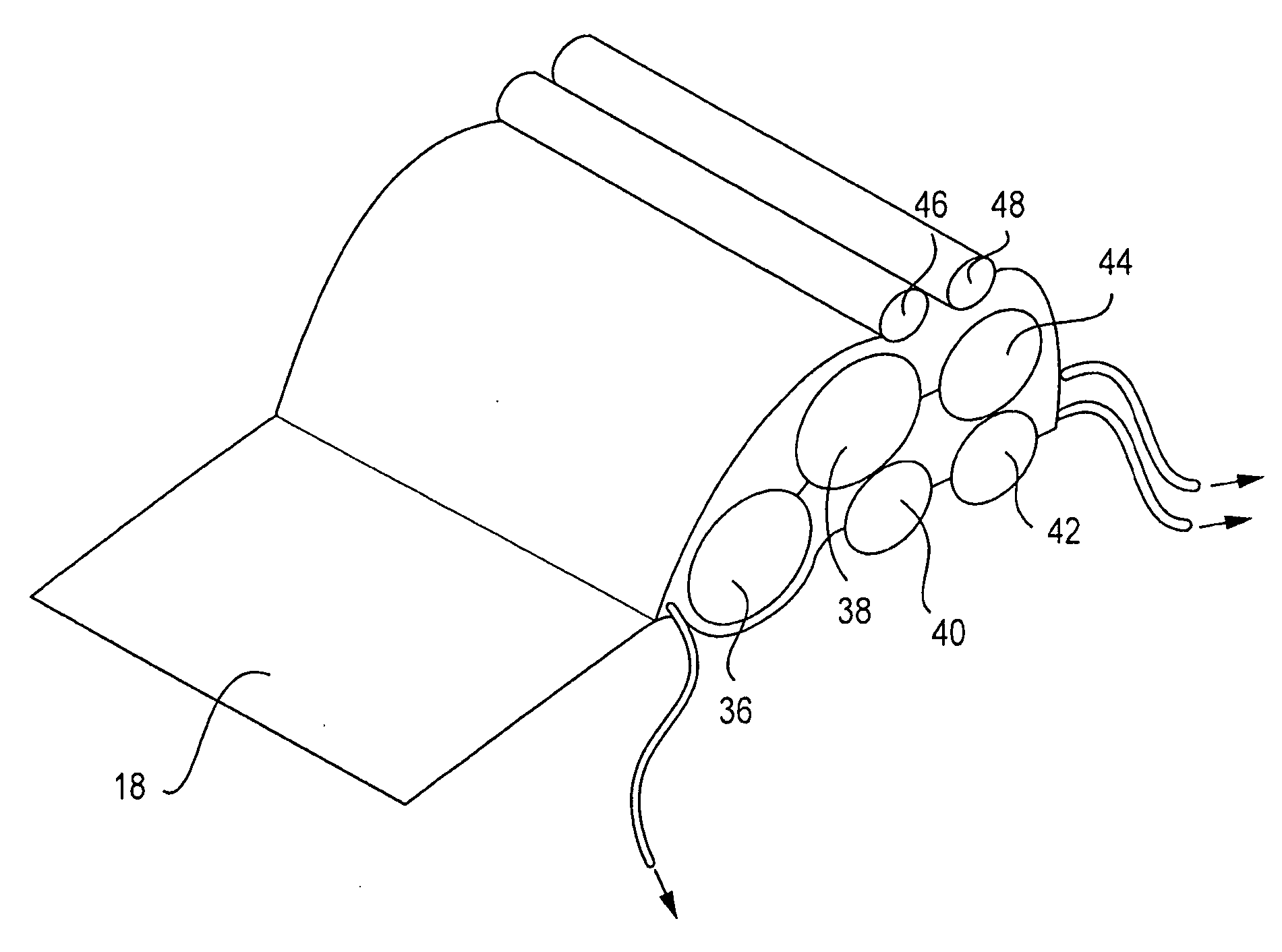 Nissen pillow