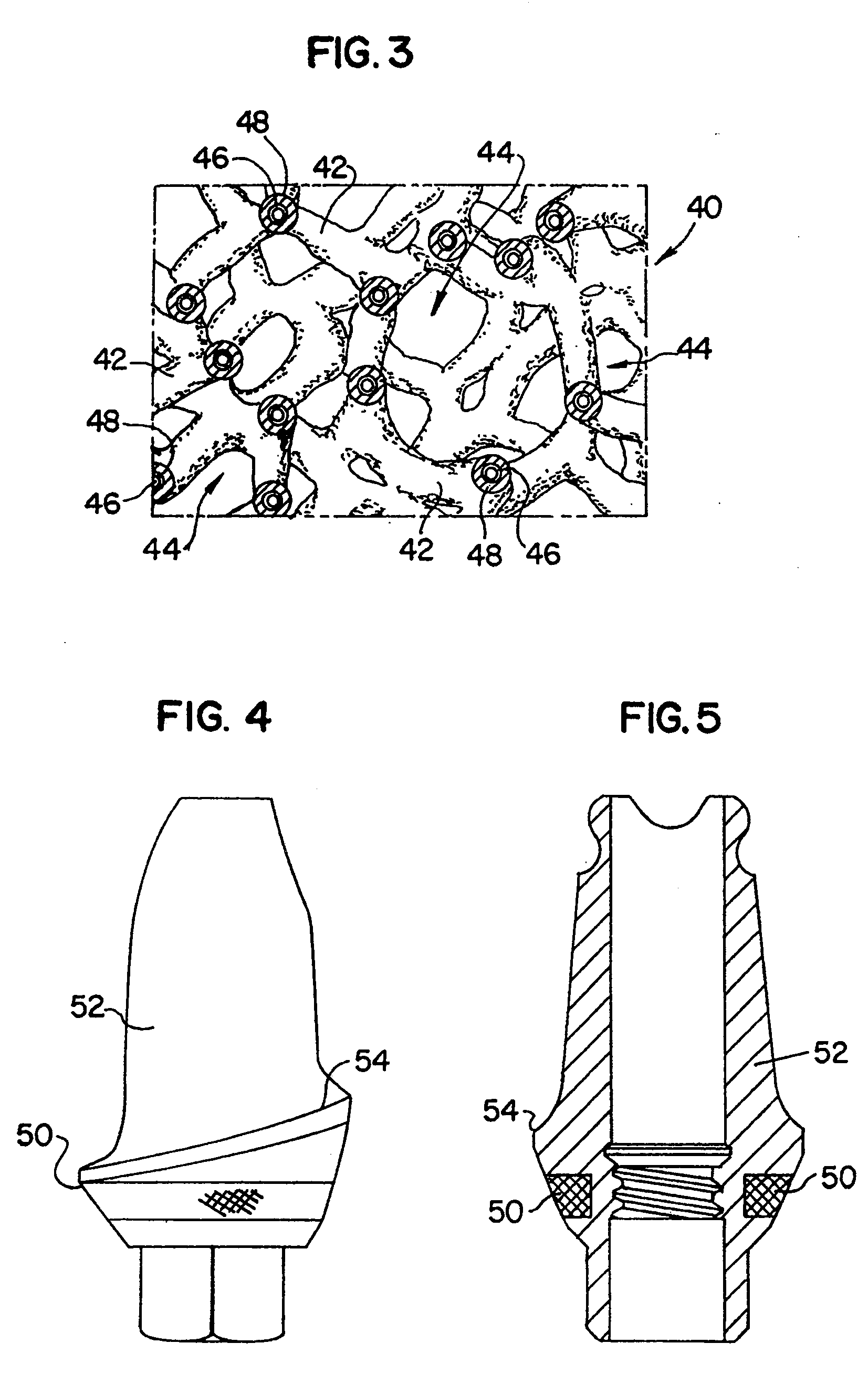 Dental prosthetic device with soft tissue barrier promotion material