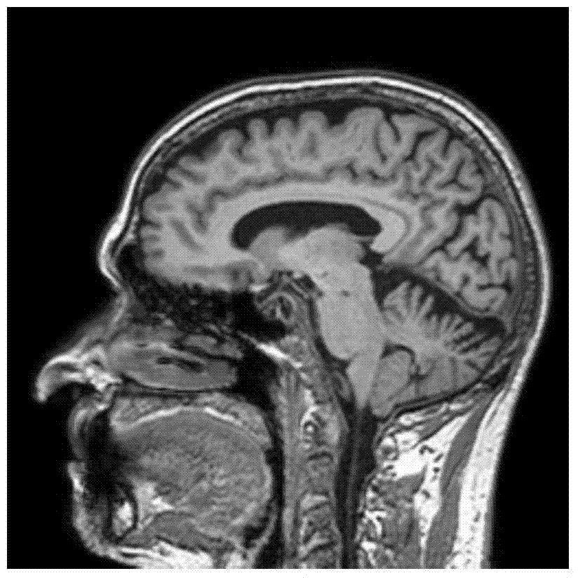 Medical image registration method based on cross hill-climbing memetic quantum evolutionary computation