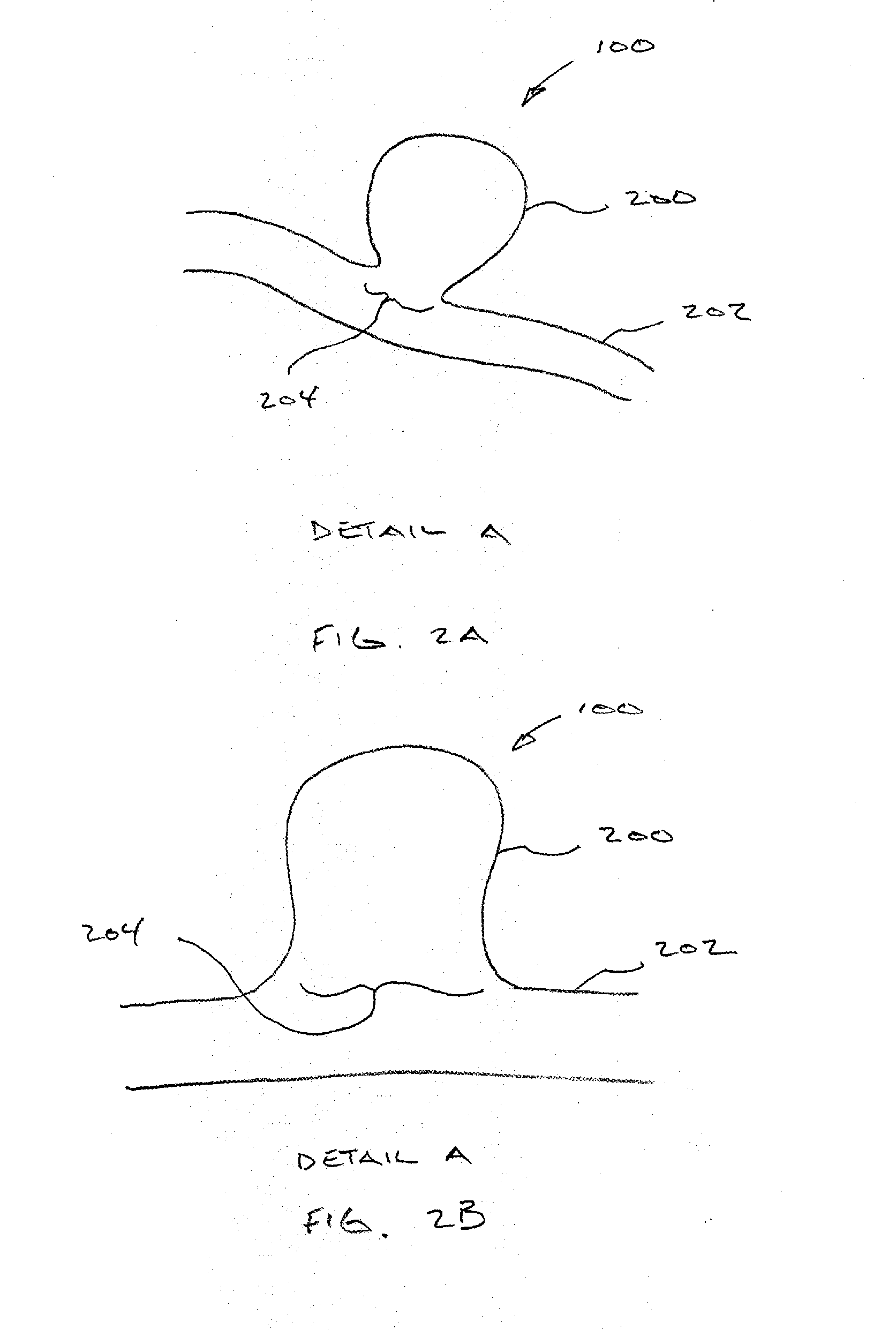 Implant for aneurysm treatment