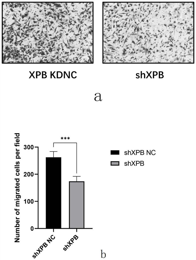 Substance for inhibiting XPB expression and endothelial cell line with XPB low expression