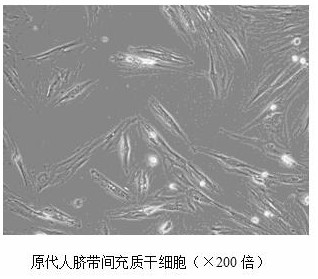 Method for efficiently inducing human umbilical cord mesenchymal stem cells to be differentiated into hepatocytes and application