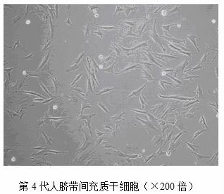 Method for efficiently inducing human umbilical cord mesenchymal stem cells to be differentiated into hepatocytes and application