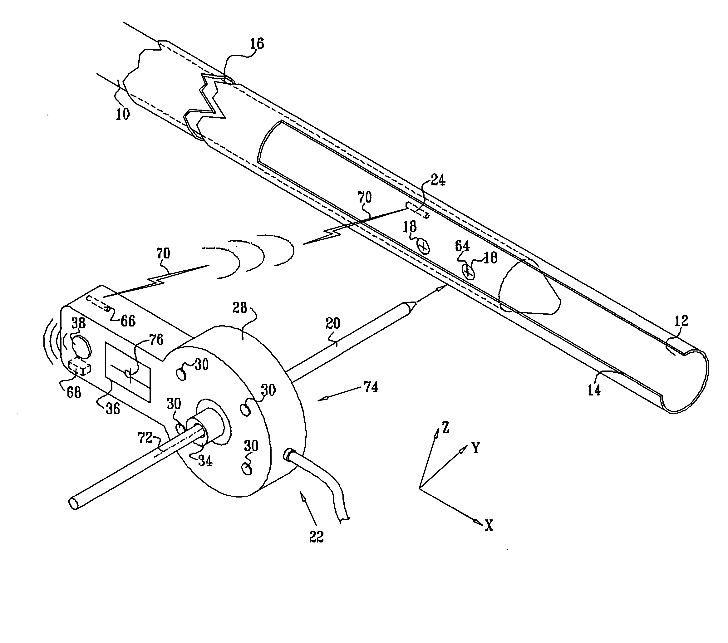 Distal targeting of locking screws in intramedullary nails