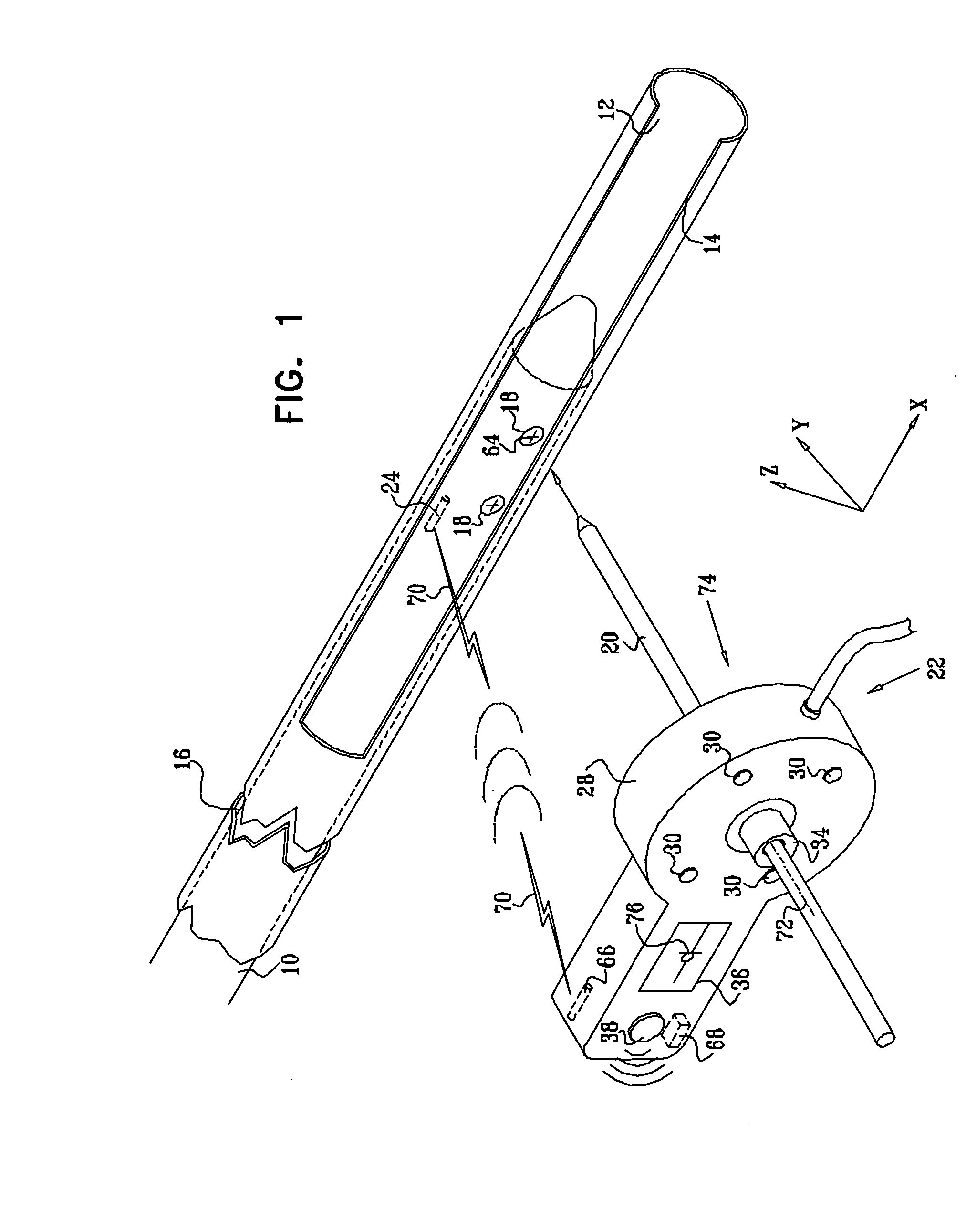 Distal targeting of locking screws in intramedullary nails