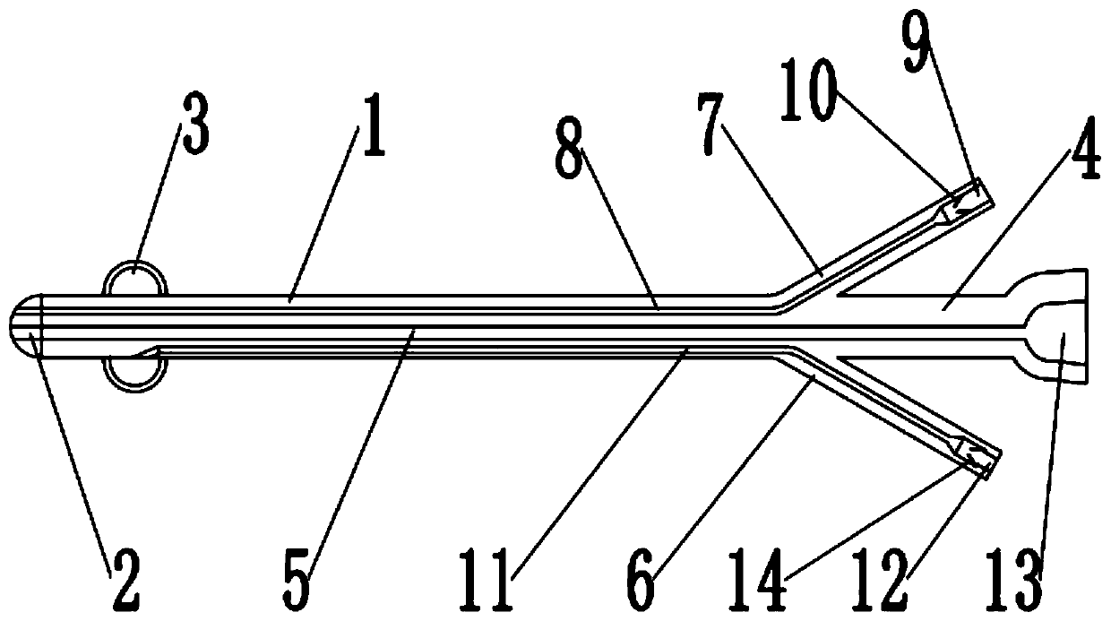 Three-cavity single-cystic fistulization tube for ileocecal part