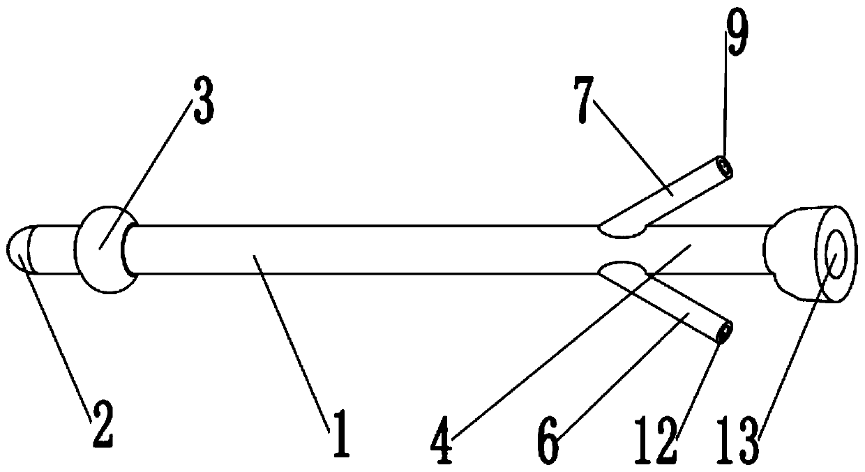 Three-cavity single-cystic fistulization tube for ileocecal part