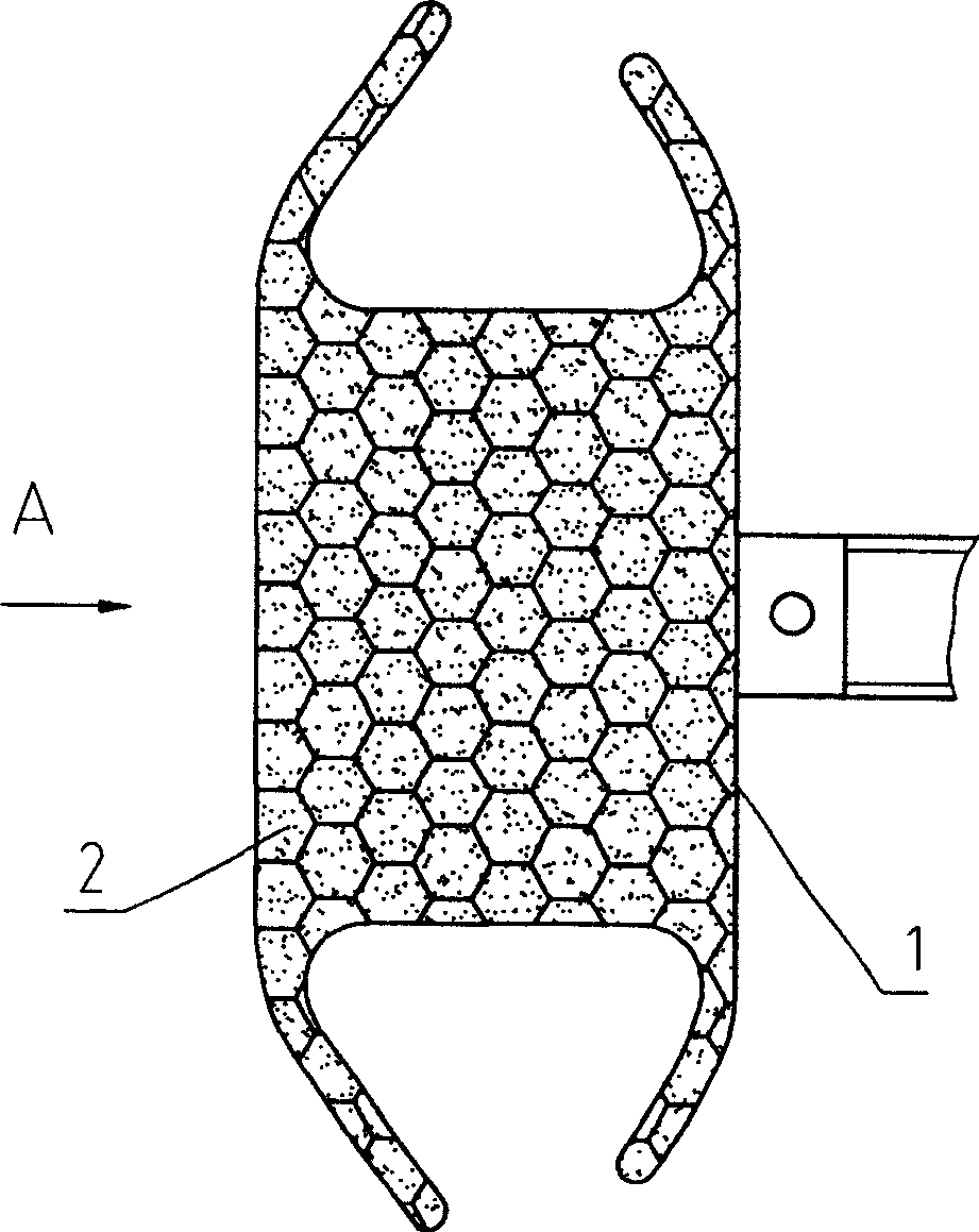 Occlusive device for treating congenital heart disease