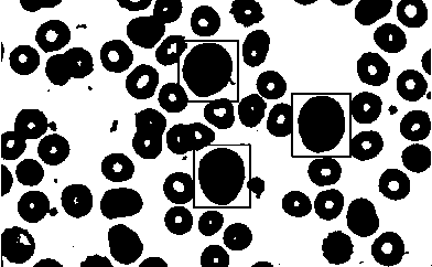 Blood smear full-view intelligent analysis method