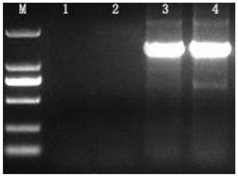 A common primer and detection method for identification of potato scab pathogen species