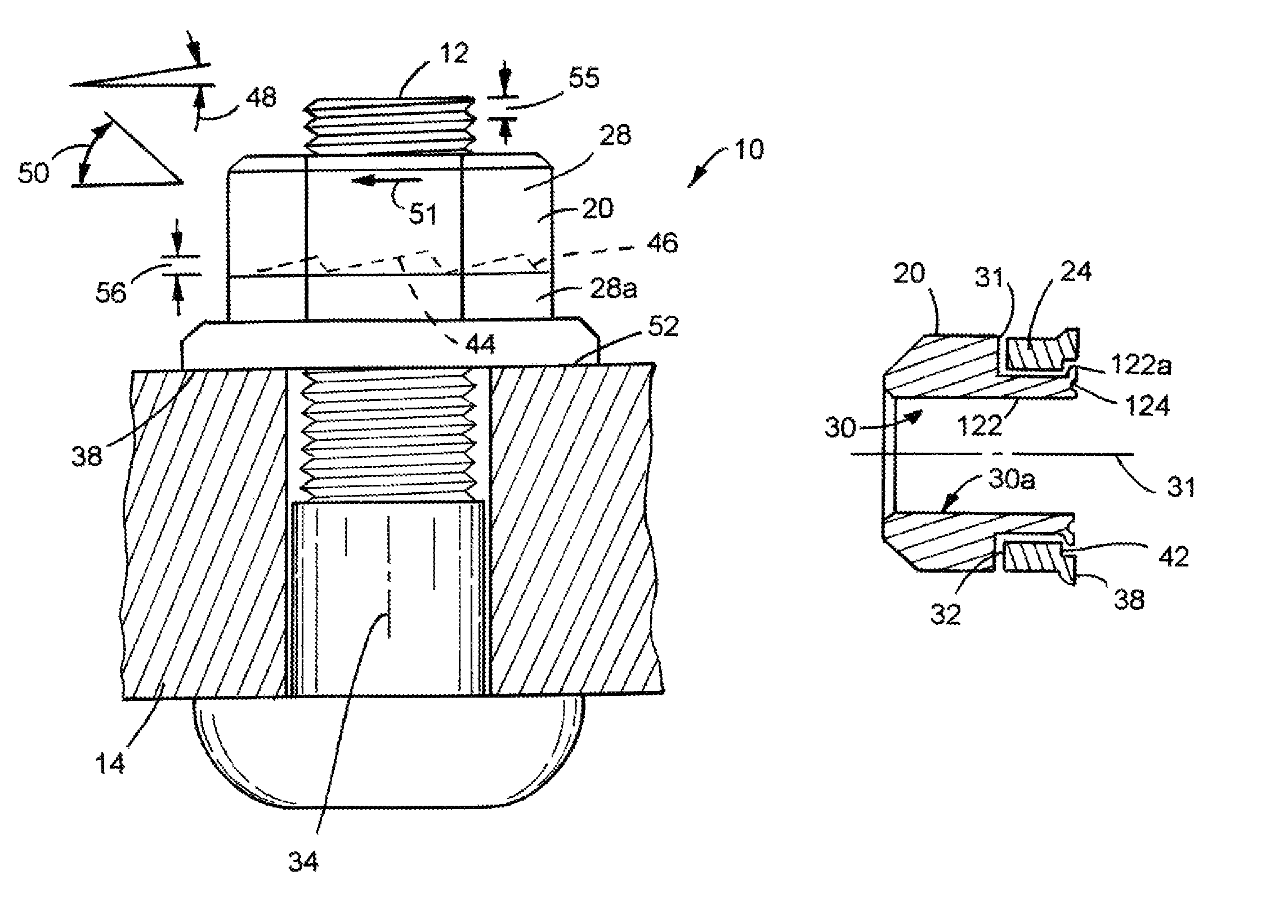 Anti-back-out fastener for applications under vibration