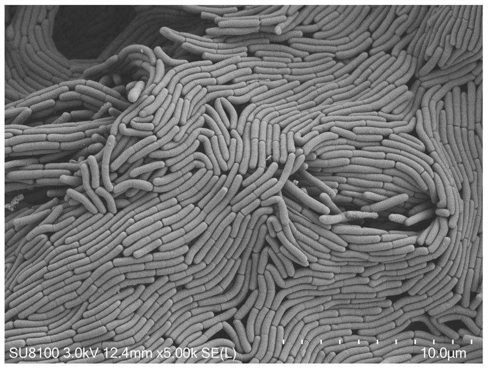 Temperature-resistant and acid-alkali-resistant strain, screening method, microbial inoculum and application