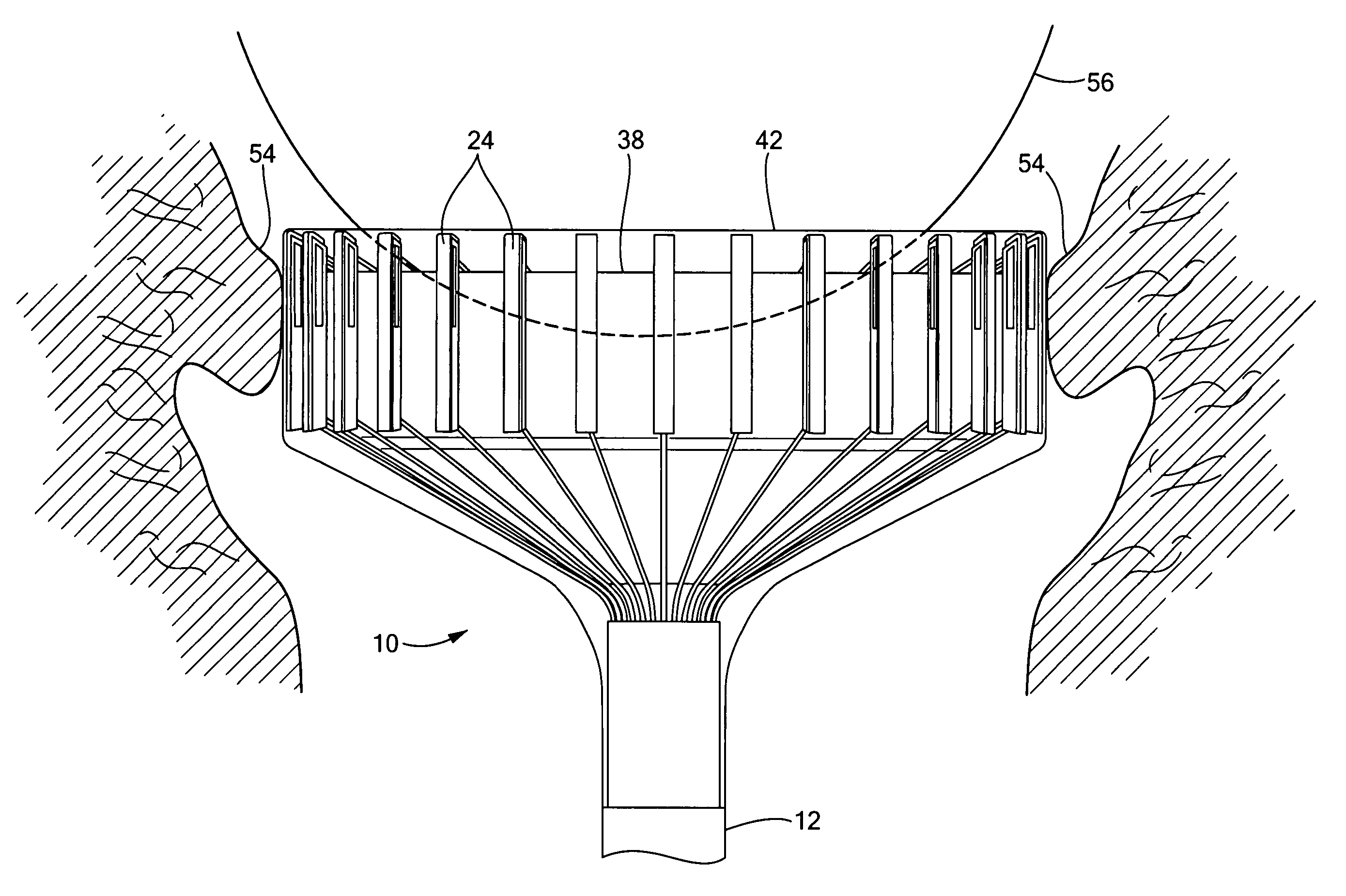 Cervimeter