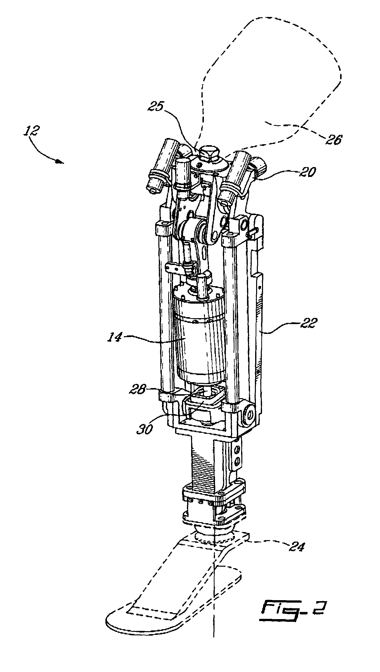 Control system and method for controlling an actuated prosthesis