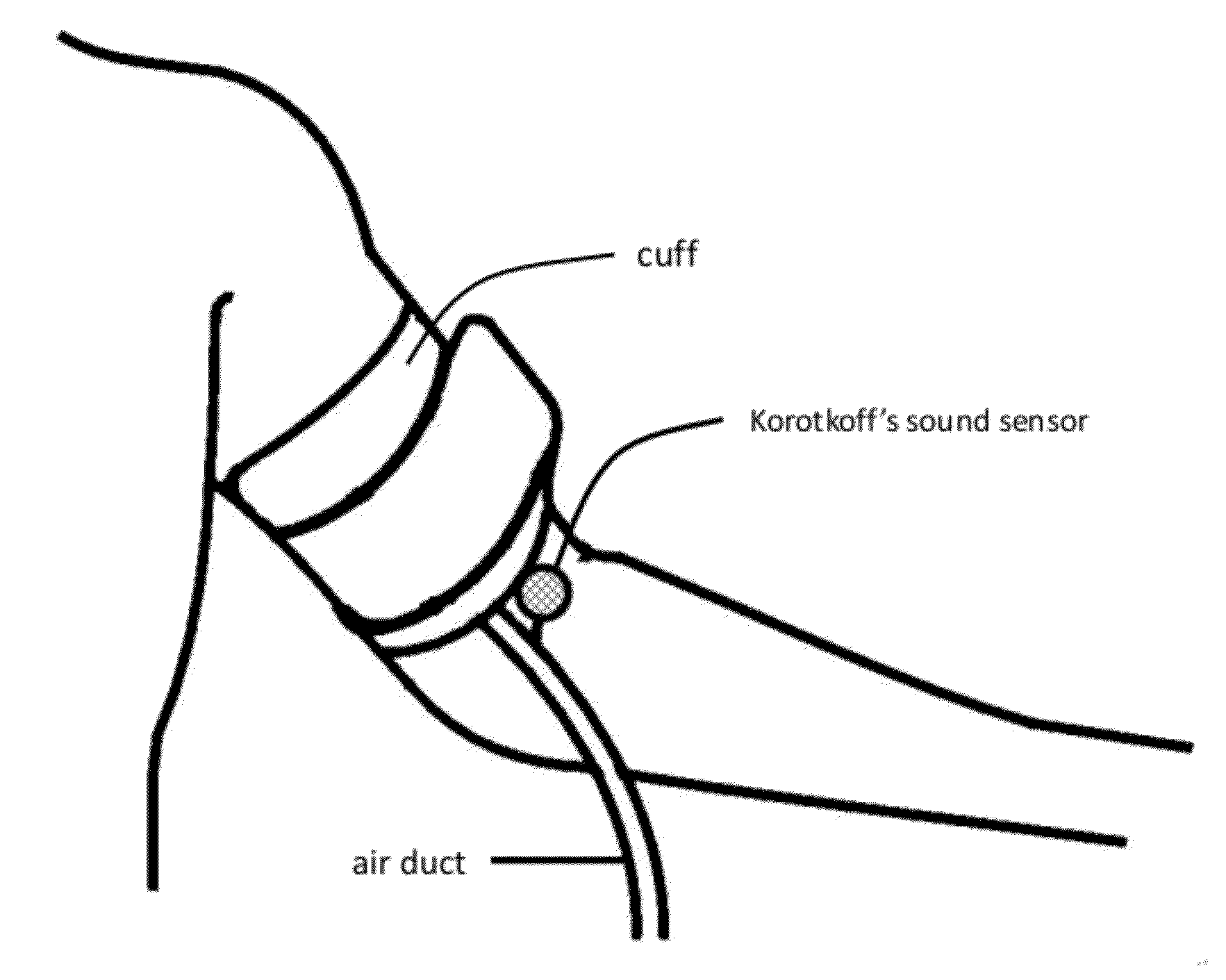 Method and apparatus for arterial blood pressure measurement and individualized rectifying technology