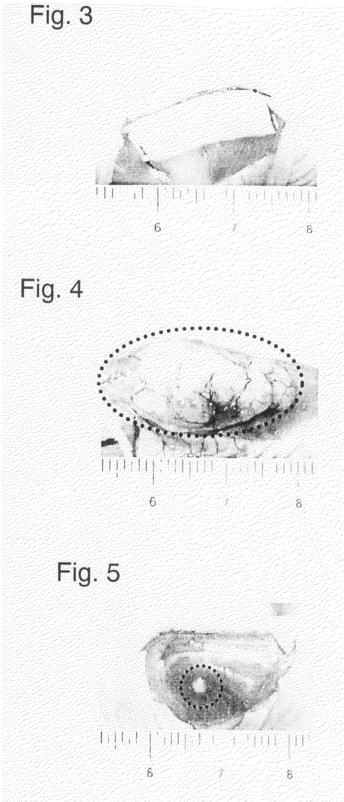 Method of Constructing Animal Having Cancer Cells Transplanted Thereinto