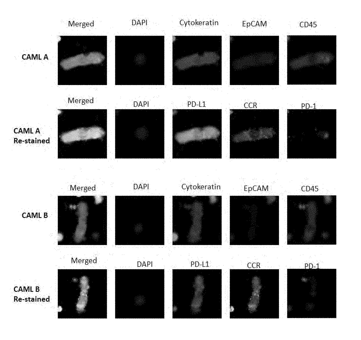 Use of circulating cell biomarkers in the blood for detection and diagnosis of diseases and methods of isolating them