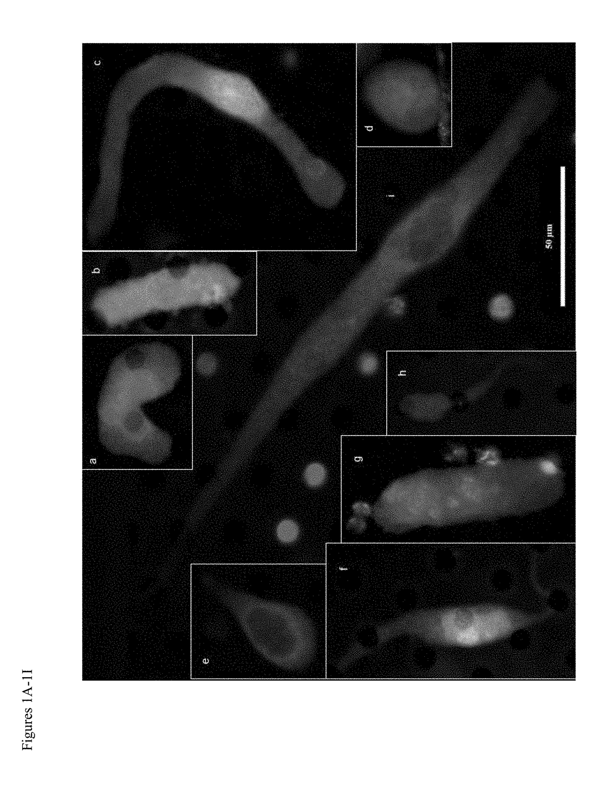 Use of circulating cell biomarkers in the blood for detection and diagnosis of diseases and methods of isolating them