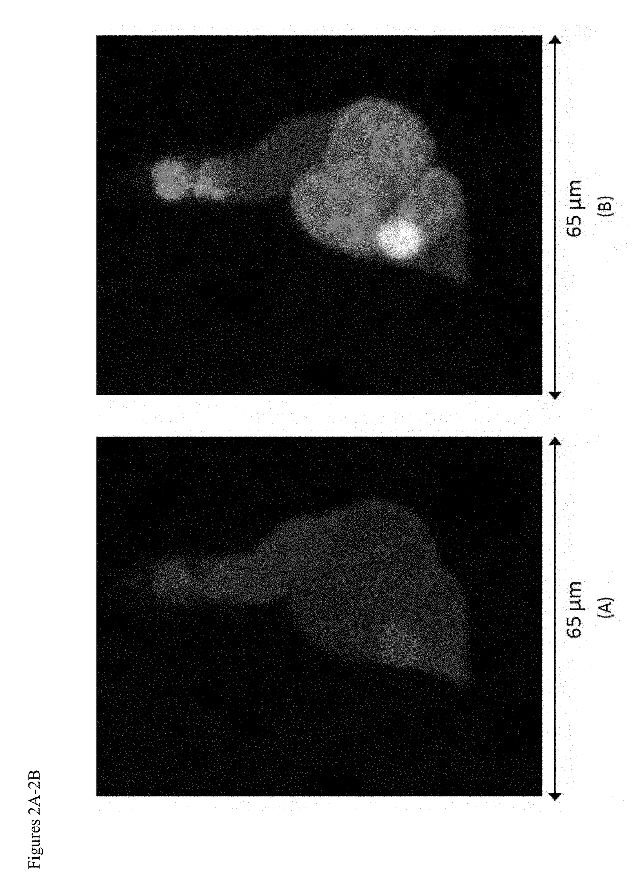 Use of circulating cell biomarkers in the blood for detection and diagnosis of diseases and methods of isolating them