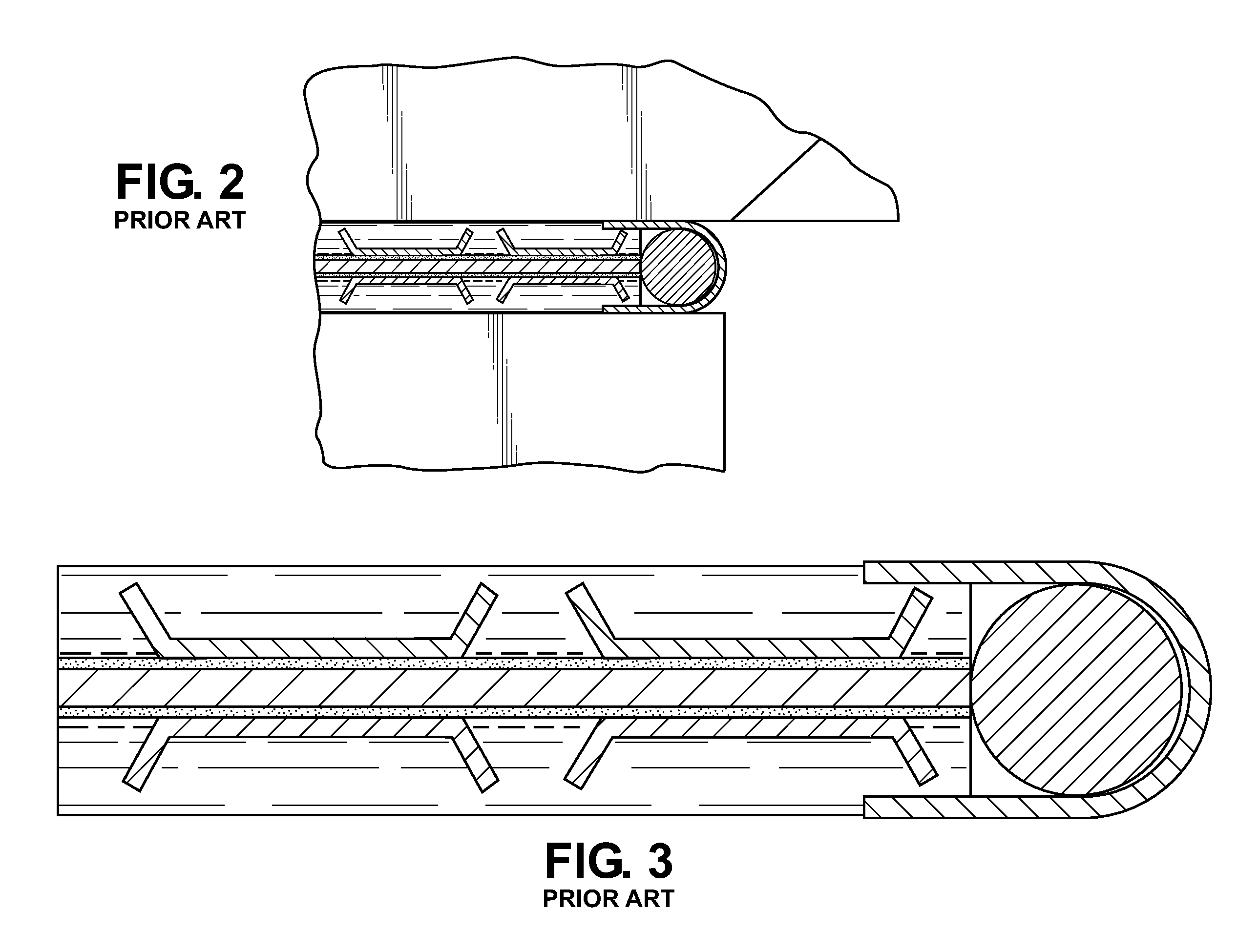 Multi-layered composite gasket